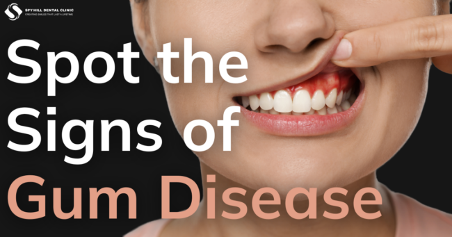 Kolen Email Feb 2025